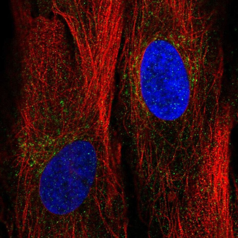Angiopoietin-like Protein 2/ANGPTL2 Antibody - BSA Free Immunocytochemistry/ Immunofluorescence: Angiopoietin-like Protein 2/ANGPTL2 Antibody [NBP1-88998]