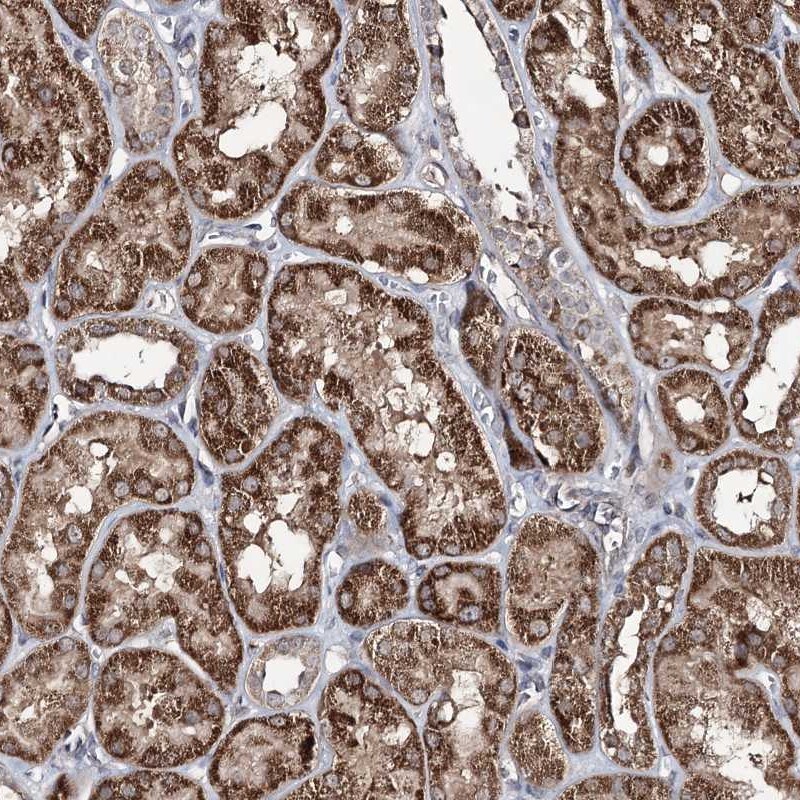 ACTR6 Antibody - BSA Free Immunohistochemistry-Paraffin: ACTR6 Antibody [NBP1-89000]
