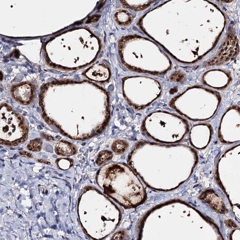 ACTR6 Antibody - BSA Free Immunohistochemistry: ACTR6 Antibody - BSA Free [NBP1-89001]