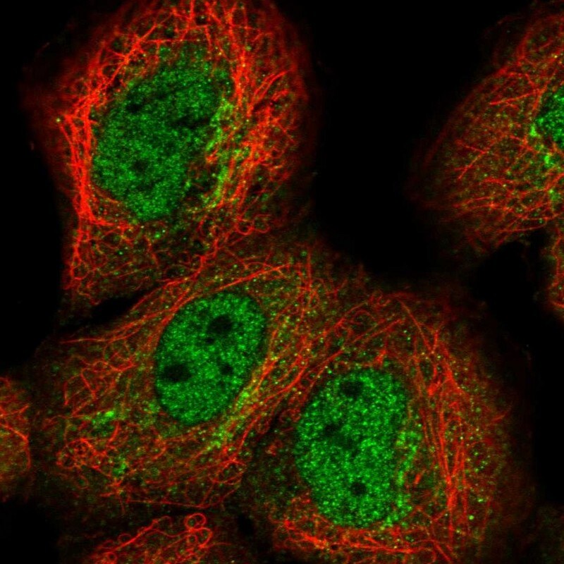 MED8 Antibody - BSA Free Immunocytochemistry/ Immunofluorescence: MED8 Antibody [NBP1-89014]