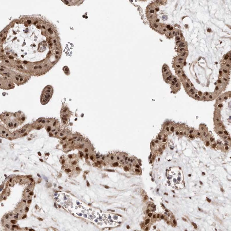MED8 Antibody - BSA Free Immunohistochemistry-Paraffin: MED8 Antibody [NBP1-89015]