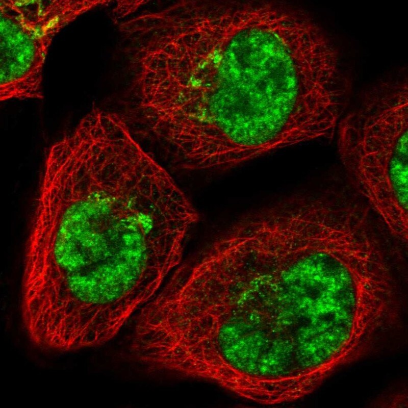 SART1 Antibody - BSA Free Immunocytochemistry/ Immunofluorescence: SART1 Antibody [NBP1-89023]