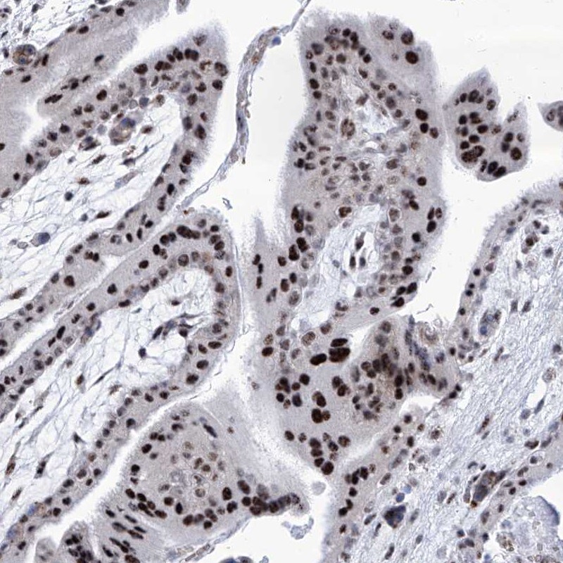 SART1 Antibody - BSA Free Immunohistochemistry-Paraffin: SART1 Antibody [NBP1-89024]