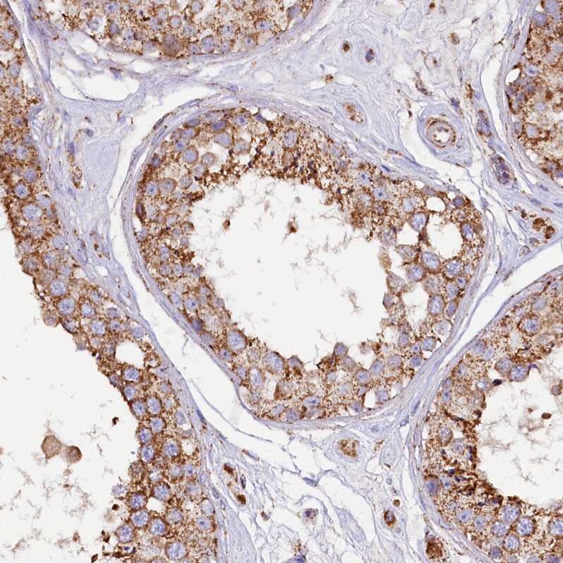APLP-2 Antibody - BSA Free Immunohistochemistry-Paraffin: APLP-2 Antibody [NBP1-89029]