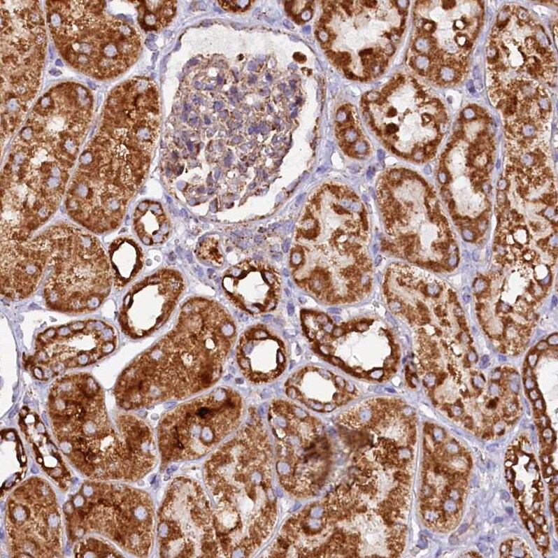 APLP-2 Antibody - BSA Free Immunohistochemistry-Paraffin: APLP-2 Antibody [NBP1-89029]
