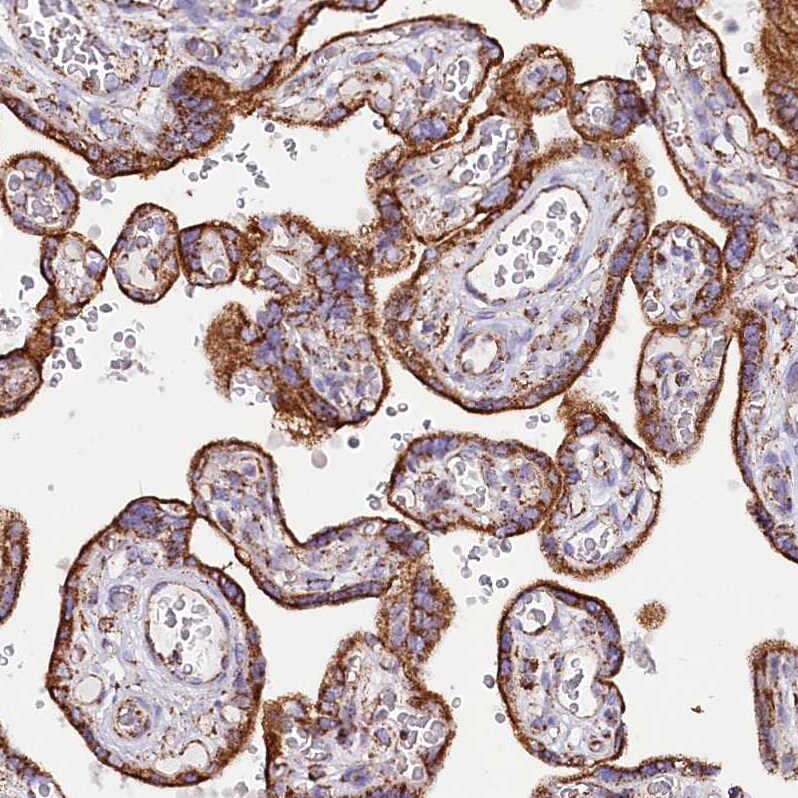 APLP-2 Antibody - BSA Free Immunohistochemistry-Paraffin: APLP-2 Antibody [NBP1-89029]