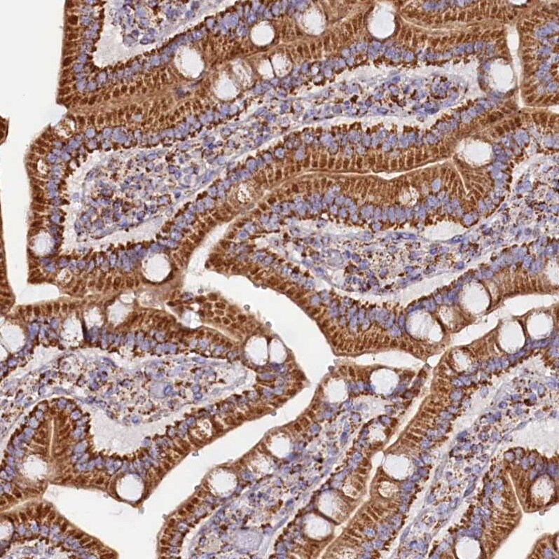 APLP-2 Antibody - BSA Free Immunohistochemistry-Paraffin: APLP-2 Antibody [NBP1-89029]