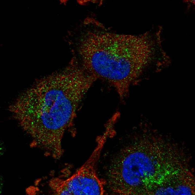 ADI1 Antibody - BSA Free Immunocytochemistry/ Immunofluorescence: ADI1 Antibody [NBP1-89037]