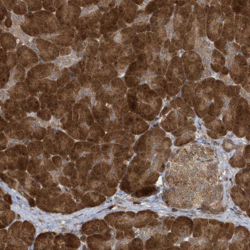 ATG4A Antibody - BSA Free Immunohistochemistry-Paraffin: ATG4A Antibody [NBP1-89044]