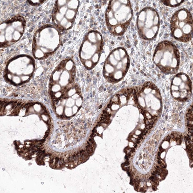 ANAPC16 Antibody - BSA Free Immunohistochemistry-Paraffin: ANAPC16 Antibody [NBP1-89048]