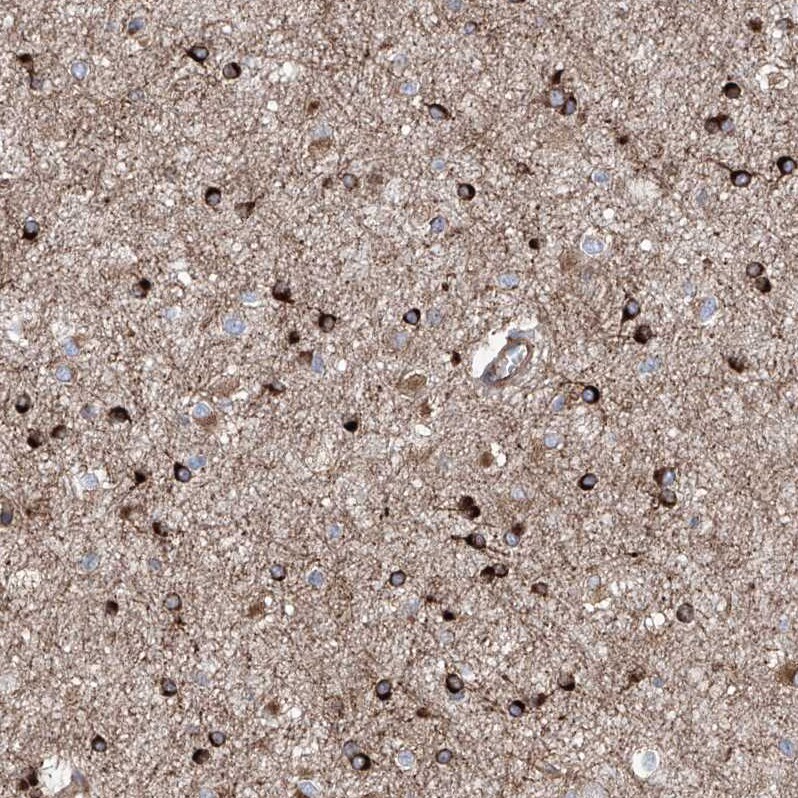 APAF-1 Antibody - BSA Free Immunohistochemistry-Paraffin: APAF-1 Antibody [NBP1-89050]