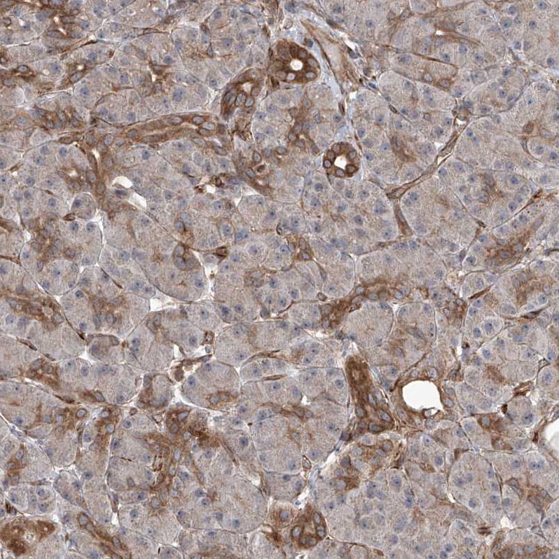 APAF-1 Antibody - BSA Free Immunohistochemistry-Paraffin: APAF-1 Antibody [NBP1-89050]