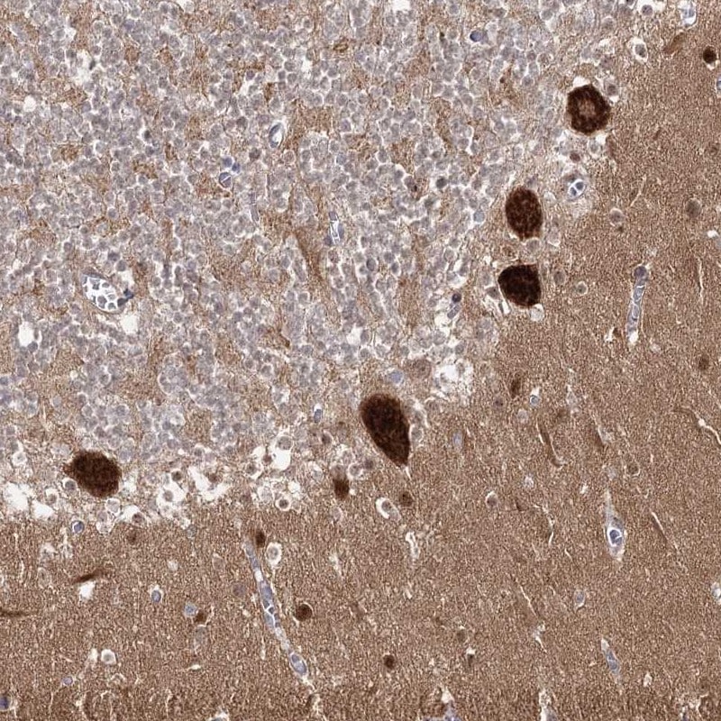 AP2M1 Antibody - BSA Free Immunohistochemistry: AP2M1 Antibody - BSA Free [NBP1-89055]