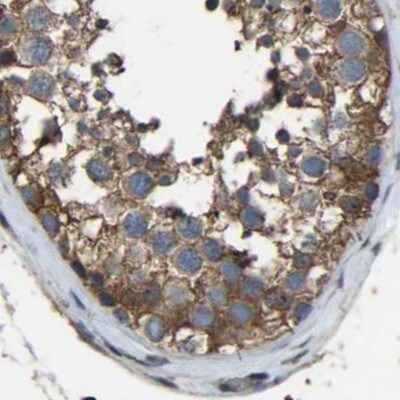 FHIT Antibody - BSA Free Immunohistochemistry-Paraffin: FHIT Antibody [NBP1-89061]