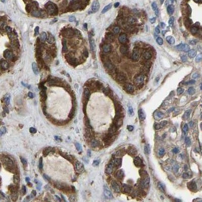 FHIT Antibody - BSA Free Immunohistochemistry-Paraffin: FHIT Antibody [NBP1-89061]