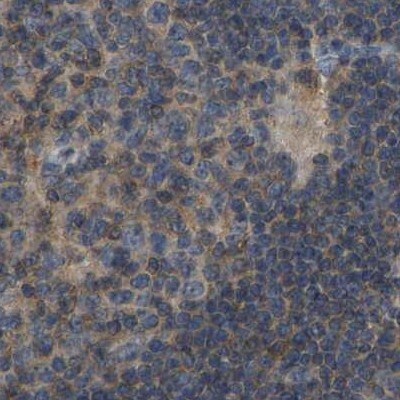 FHIT Antibody - BSA Free Immunohistochemistry-Paraffin: FHIT Antibody [NBP1-89061]