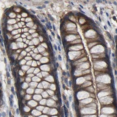FHIT Antibody - BSA Free Immunohistochemistry-Paraffin: FHIT Antibody [NBP1-89061]