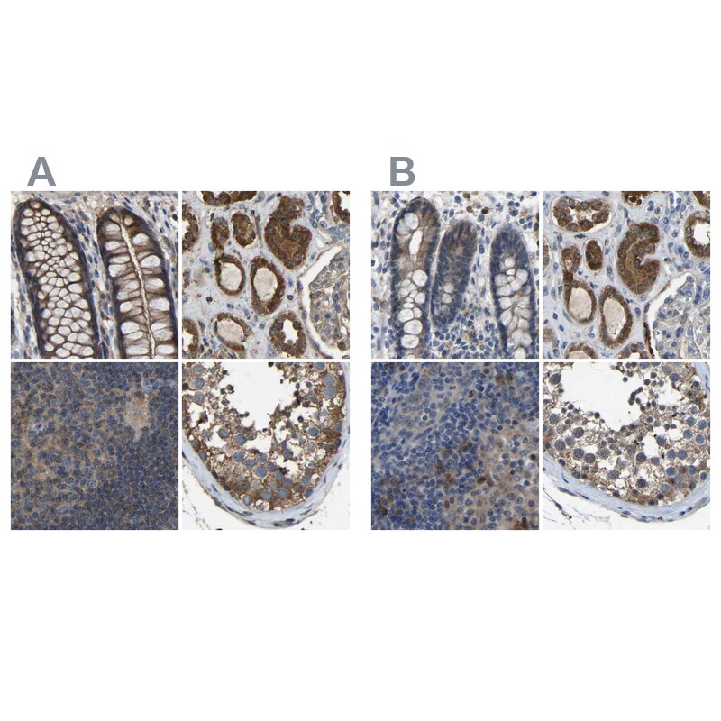FHIT Antibody - BSA Free Immunohistochemistry-Paraffin: FHIT Antibody [NBP1-89061]