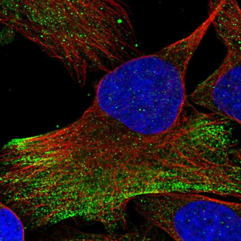 RNF25 Antibody - BSA Free Immunocytochemistry/ Immunofluorescence: RNF25 Antibody [NBP1-89069]