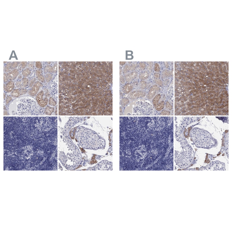 Aldehyde Oxidase 1/AOX1 Antibody Immunohistochemistry-Paraffin: Aldehyde Oxidase 1/AOX1 Antibody Antibody [NBP1-89070]