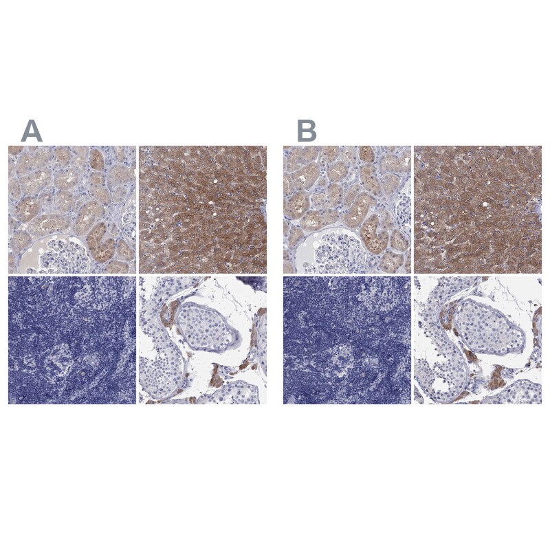 Aldehyde Oxidase 1/AOX1 Antibody - BSA Free Immunohistochemistry-Paraffin: Aldehyde Oxidase 1/AOX1 Antibody [NBP1-89071]