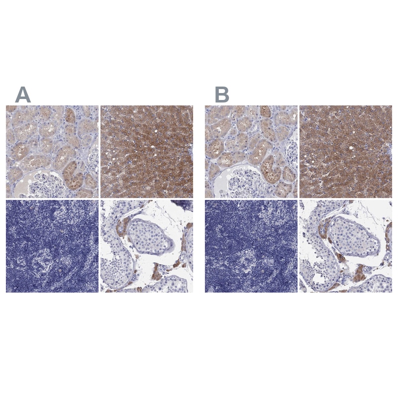 Aldehyde Oxidase 1/AOX1 Antibody Immunohistochemistry-Paraffin: Aldehyde Oxidase 1/AOX1 Antibody Antibody [NBP1-89071]