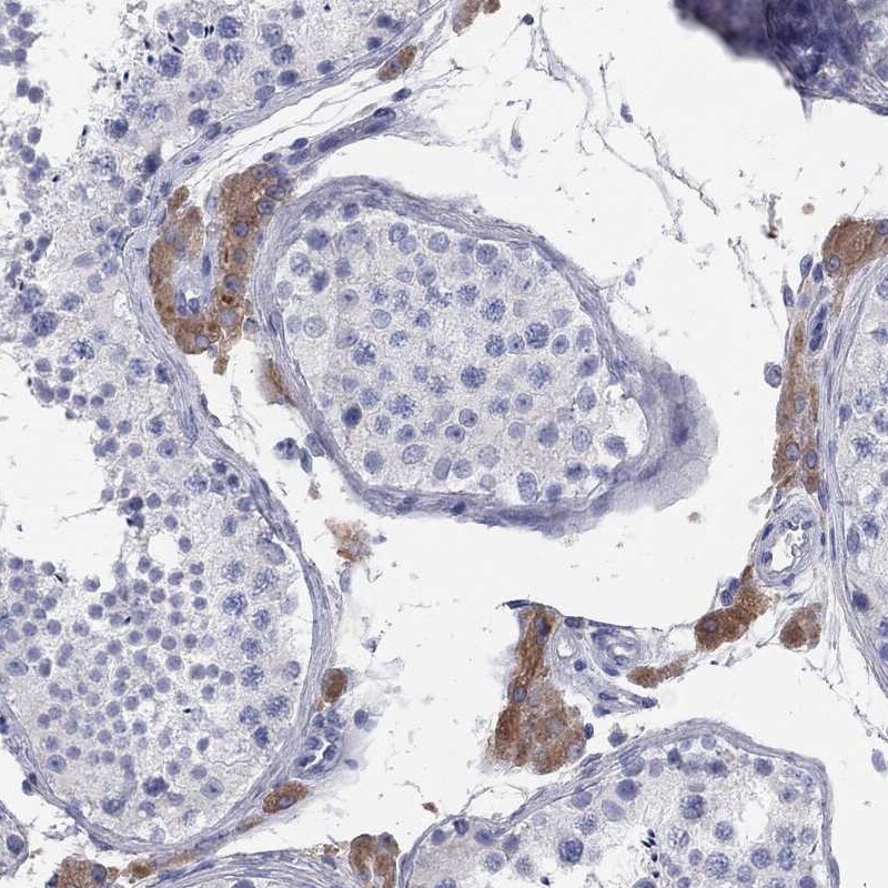 Aldehyde Oxidase 1/AOX1 Antibody Immunohistochemistry-Paraffin: Aldehyde Oxidase 1/AOX1 Antibody [NBP1-89071]