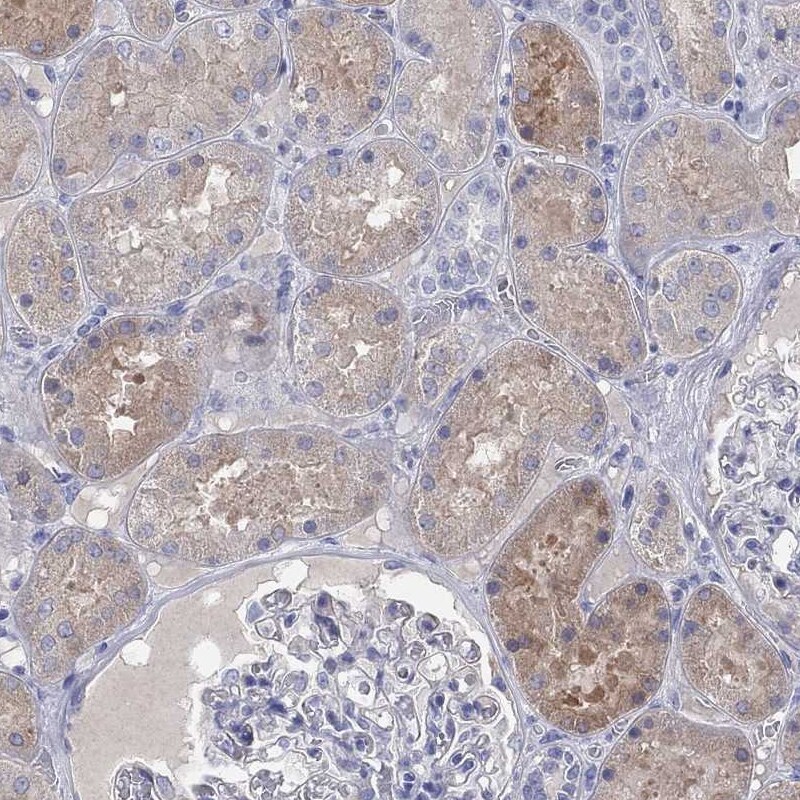 Aldehyde Oxidase 1/AOX1 Antibody Immunohistochemistry-Paraffin: Aldehyde Oxidase 1/AOX1 Antibody [NBP1-89071]