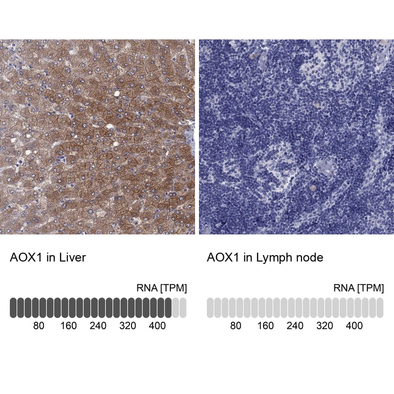 Aldehyde Oxidase 1/AOX1 Antibody Immunohistochemistry-Paraffin: Aldehyde Oxidase 1/AOX1 Antibody [NBP1-89071]