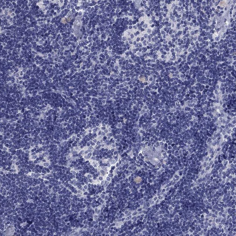 Aldehyde Oxidase 1/AOX1 Antibody Immunohistochemistry-Paraffin: Aldehyde Oxidase 1/AOX1 Antibody [NBP1-89071]