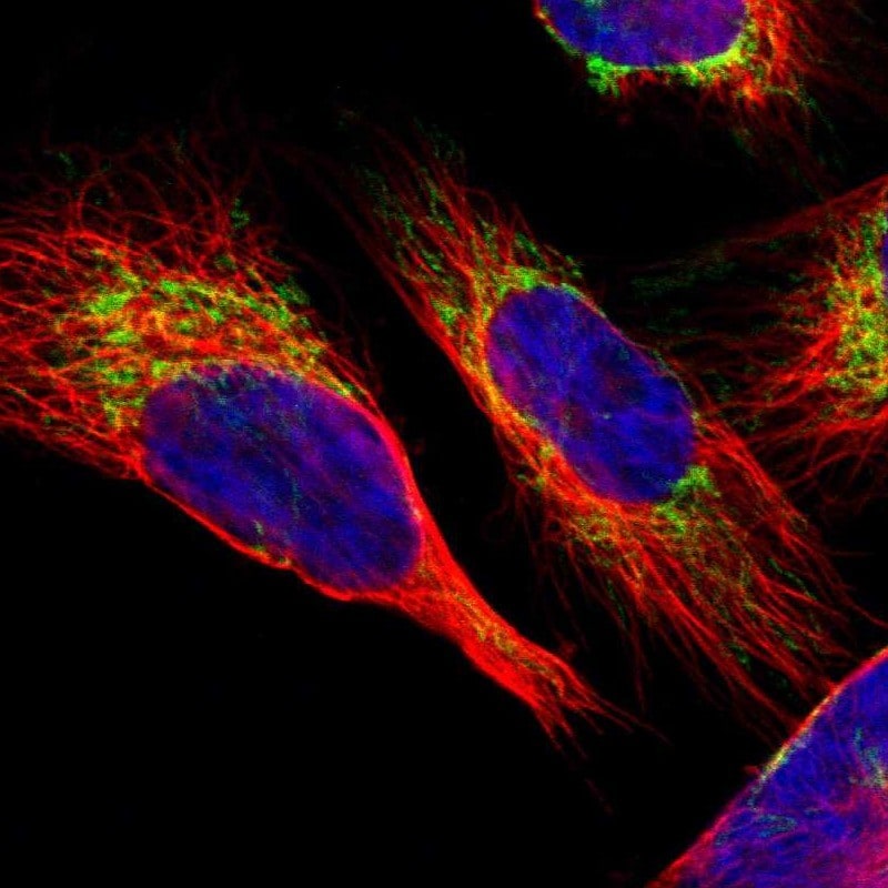 SLC25A31 Antibody - BSA Free Immunocytochemistry/ Immunofluorescence: SLC25A31 Antibody [NBP1-89073]