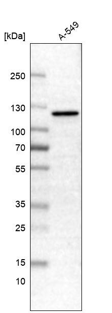 CDKL5 Antibody Western Blot: CDKL5 Antibody [NBP1-84881]