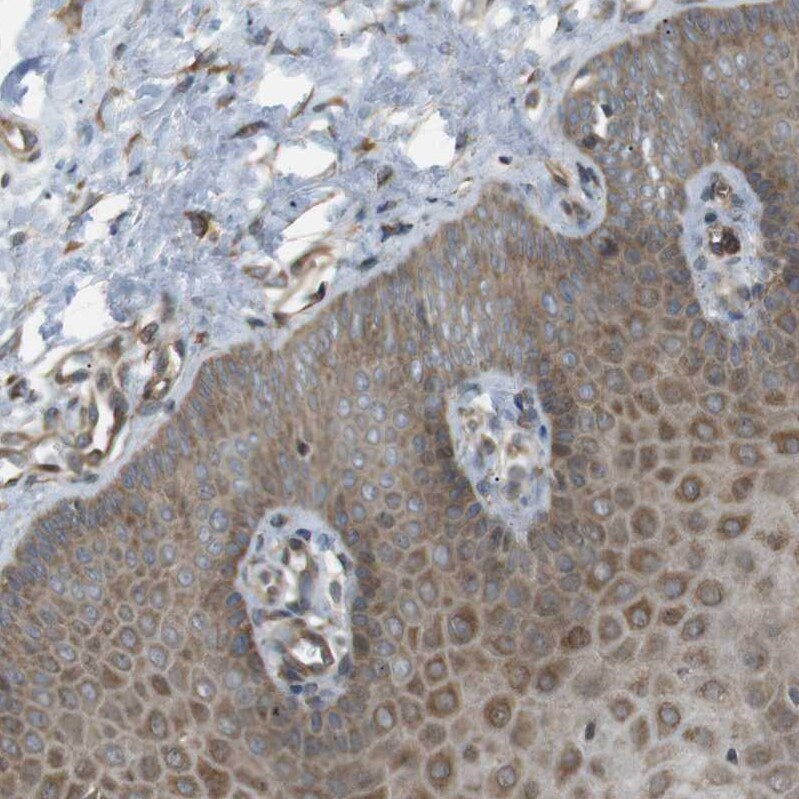 KANK2 Antibody - BSA Free Immunohistochemistry: KANK2 Antibody [NBP1-89080]