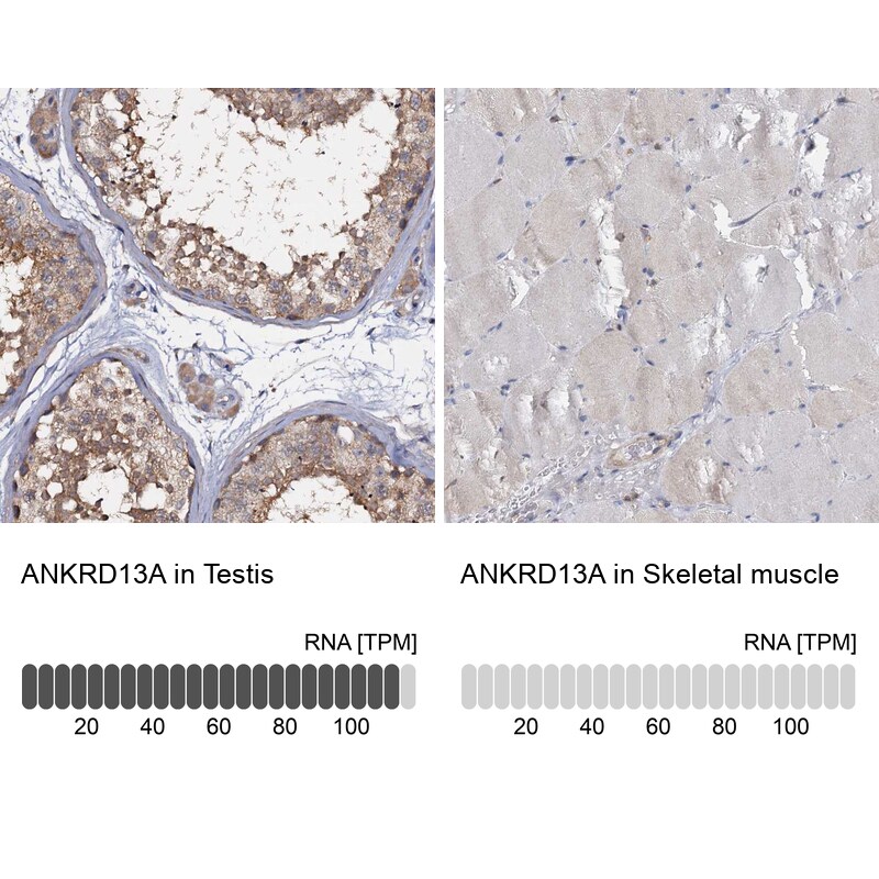 ANKRD13A Antibody - BSA Free Immunohistochemistry-Paraffin: ANKRD13A Antibody [NBP1-89082]