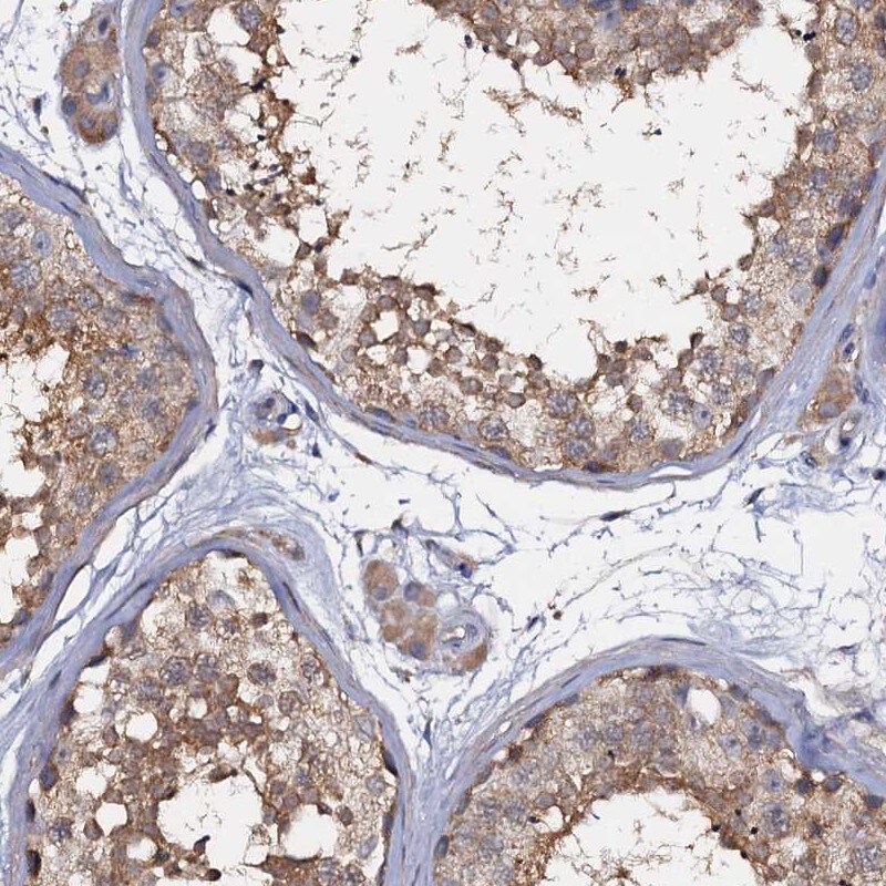 ANKRD13A Antibody - BSA Free Immunohistochemistry-Paraffin: ANKRD13A Antibody [NBP1-89082]