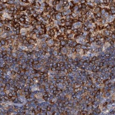 ANKRD13A Antibody - BSA Free Immunohistochemistry-Paraffin: ANKRD13A Antibody [NBP1-89082]