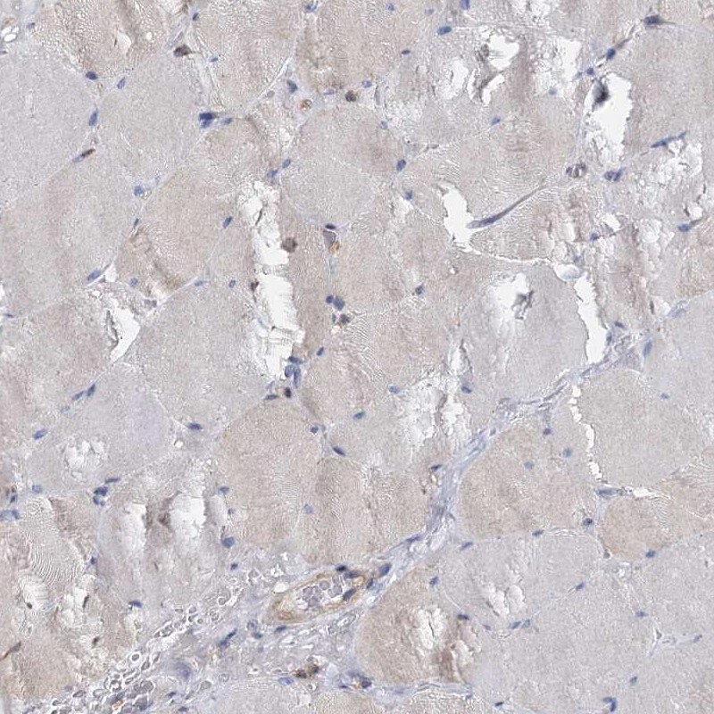 ANKRD13A Antibody - BSA Free Immunohistochemistry-Paraffin: ANKRD13A Antibody [NBP1-89082]