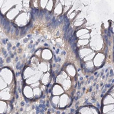 ANKRD13A Antibody - BSA Free Immunohistochemistry-Paraffin: ANKRD13A Antibody [NBP1-89082]