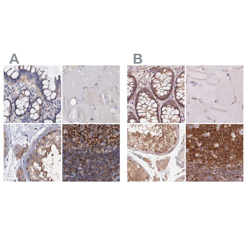 ANKRD13A Antibody - BSA Free Immunohistochemistry-Paraffin: ANKRD13A Antibody [NBP1-89082]