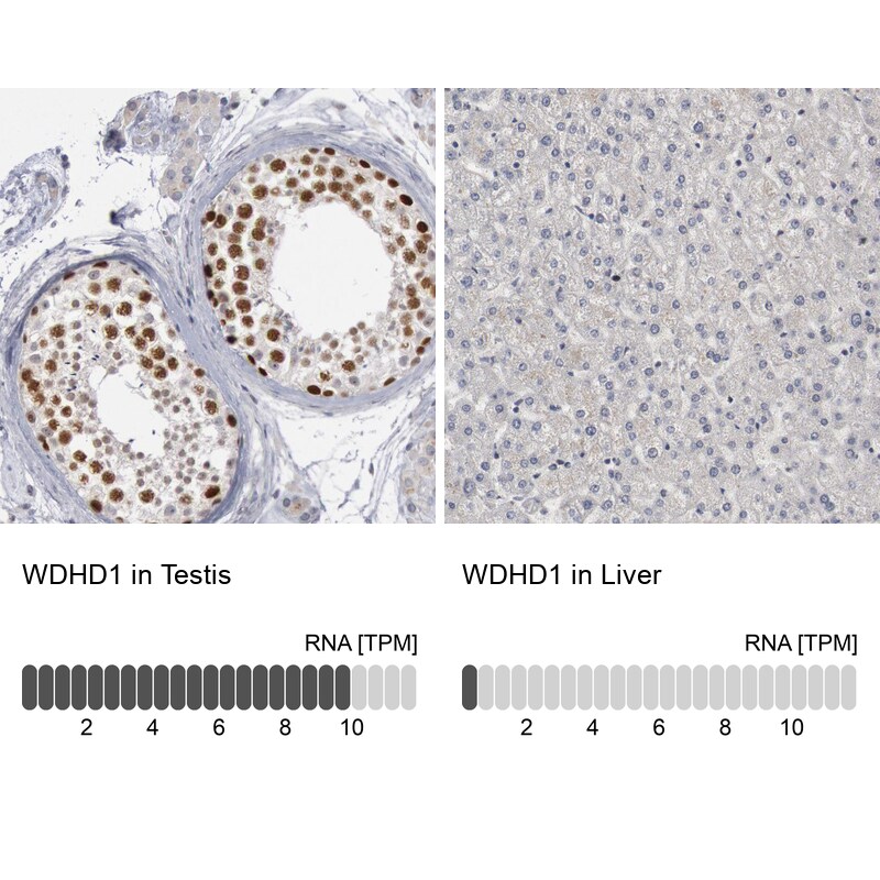 WDHD1 Antibody - BSA Free Immunohistochemistry-Paraffin: WDHD1 Antibody [NBP1-89091]