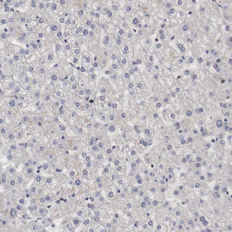 WDHD1 Antibody - BSA Free Immunohistochemistry-Paraffin: WDHD1 Antibody [NBP1-89091]