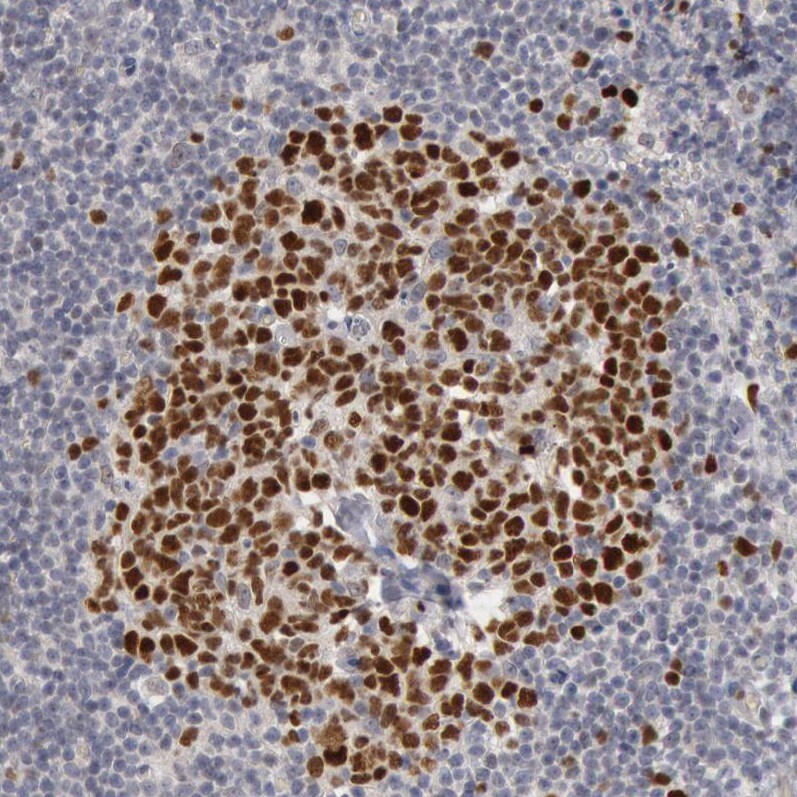 WDHD1 Antibody - BSA Free Immunohistochemistry-Paraffin: WDHD1 Antibody [NBP1-89091]