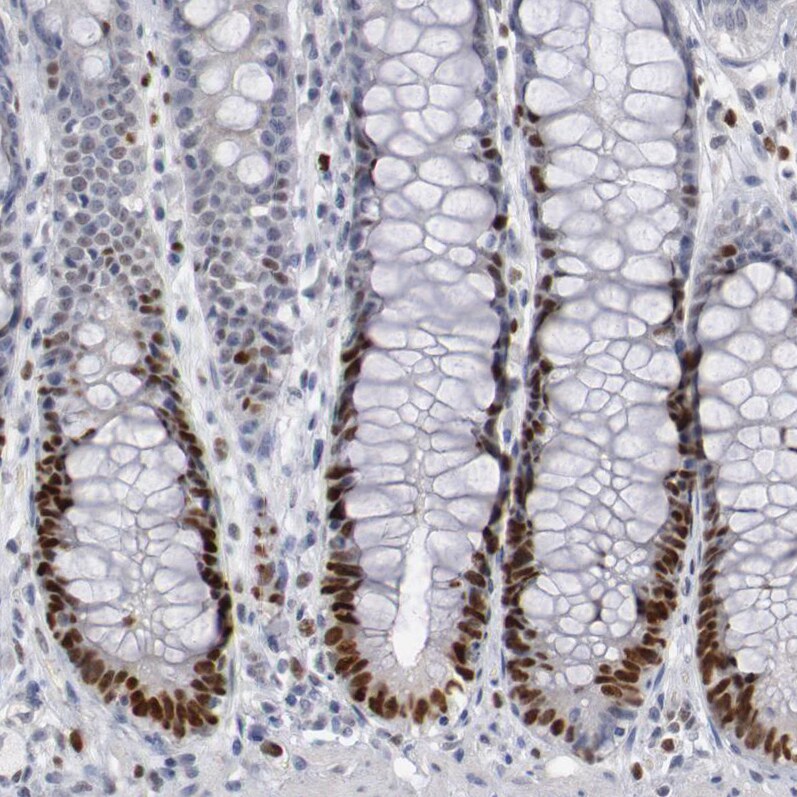 WDHD1 Antibody - BSA Free Immunohistochemistry-Paraffin: WDHD1 Antibody [NBP1-89091]