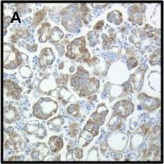 CIAPIN1 Antibody