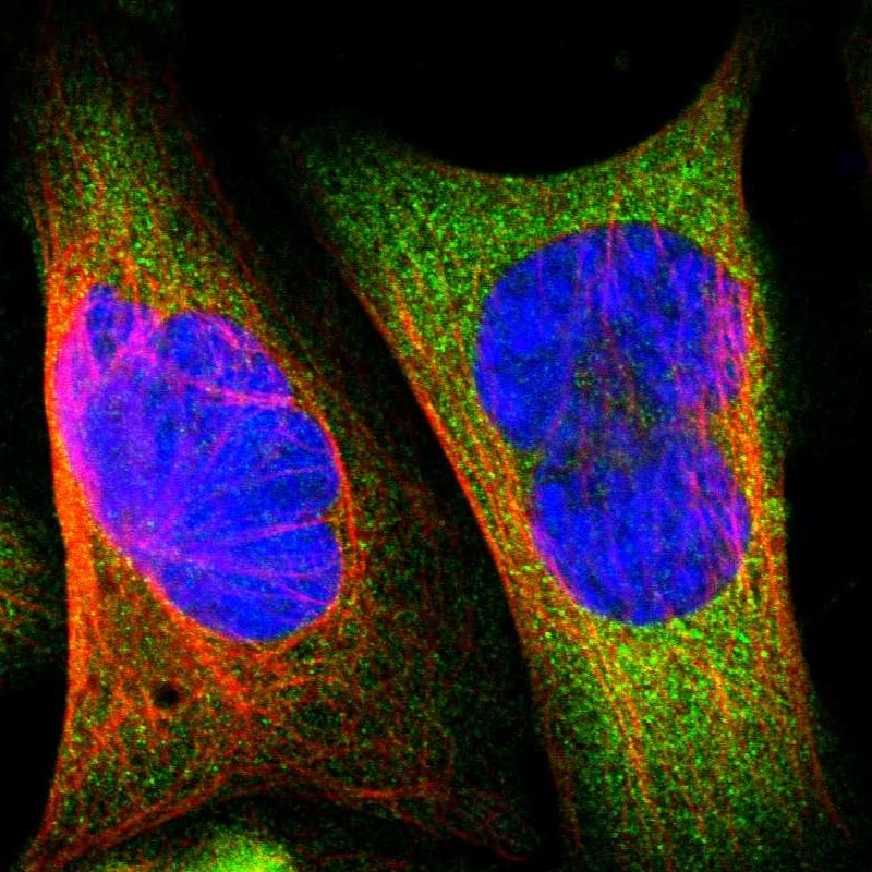 BIN1 Antibody - BSA Free Immunocytochemistry/ Immunofluorescence: BIN1 Antibody [NBP1-89102]