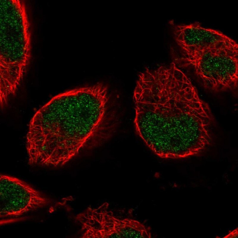 IGFALS/ALS Antibody - BSA Free Immunocytochemistry/ Immunofluorescence: IGFALS/ALS Antibody [NBP1-89117]