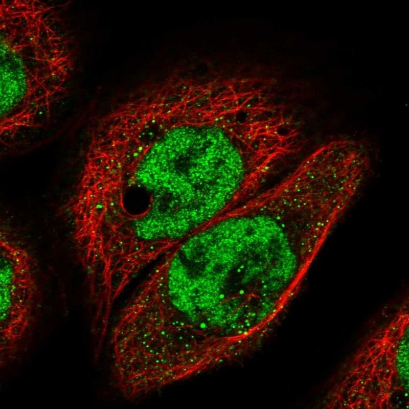 IGFALS/ALS Antibody - BSA Free Immunocytochemistry/ Immunofluorescence: IGFALS/ALS Antibody [NBP1-89118]