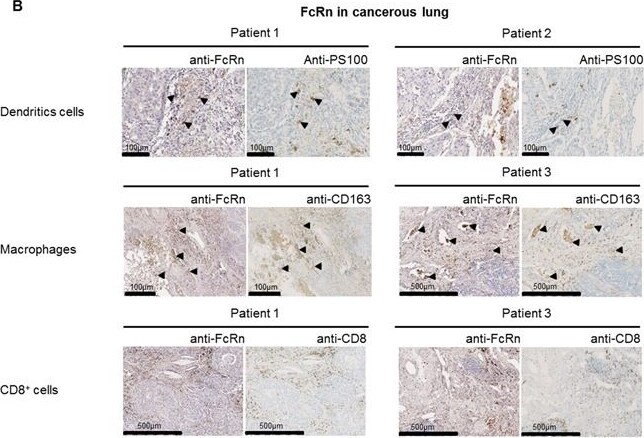 FCRN/FCGRT Antibody - BSA Free
