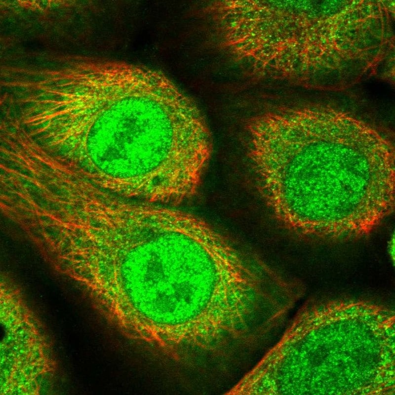 AKR1B1 Antibody - BSA Free Immunocytochemistry/ Immunofluorescence: AKR1B1 Antibody [NBP1-89146]