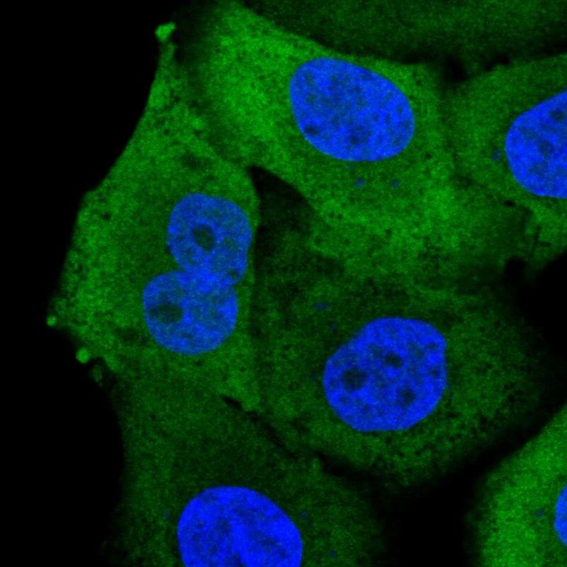 Aldo-keto Reductase 1B10/AKR1B10 Antibody - BSA Free Immunocytochemistry/ Immunofluorescence: Aldo-keto Reductase 1B10/AKR1B10 Antibody [NBP1-89161]